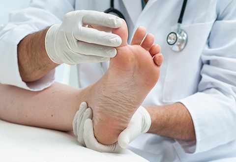 How to Manage the Diabetic Foot in Primary Care